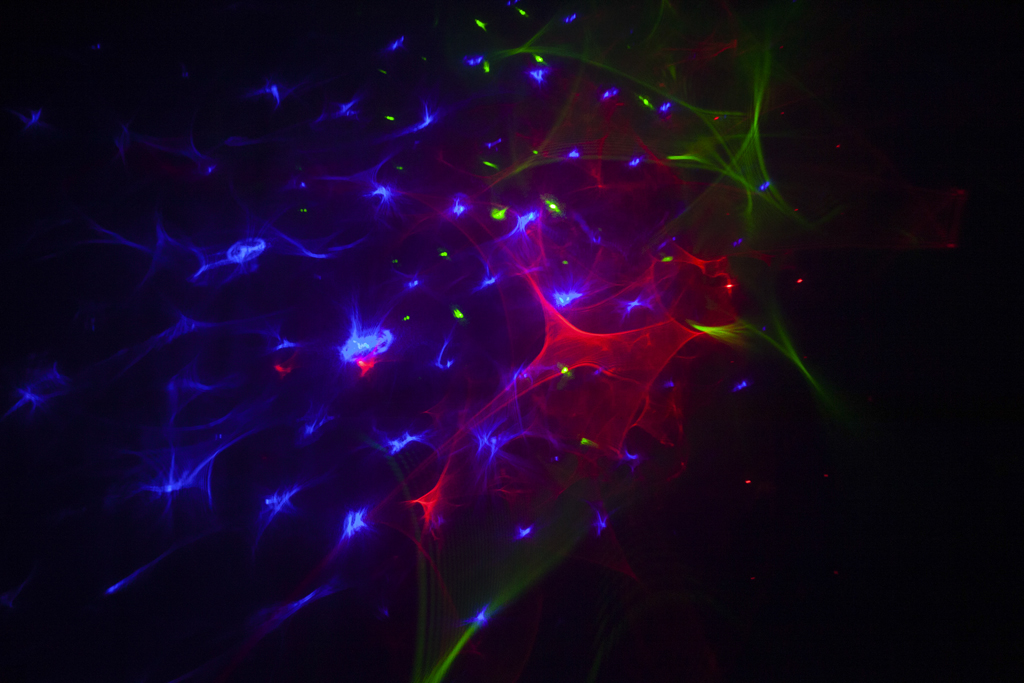 LisForLaser_13